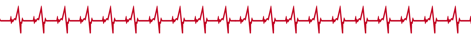 Piercing-Factory-Bielefeld__Stoerlinie