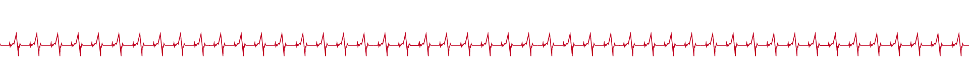 Piercing-Factory-Bielefeld__Stoerlinie_fein